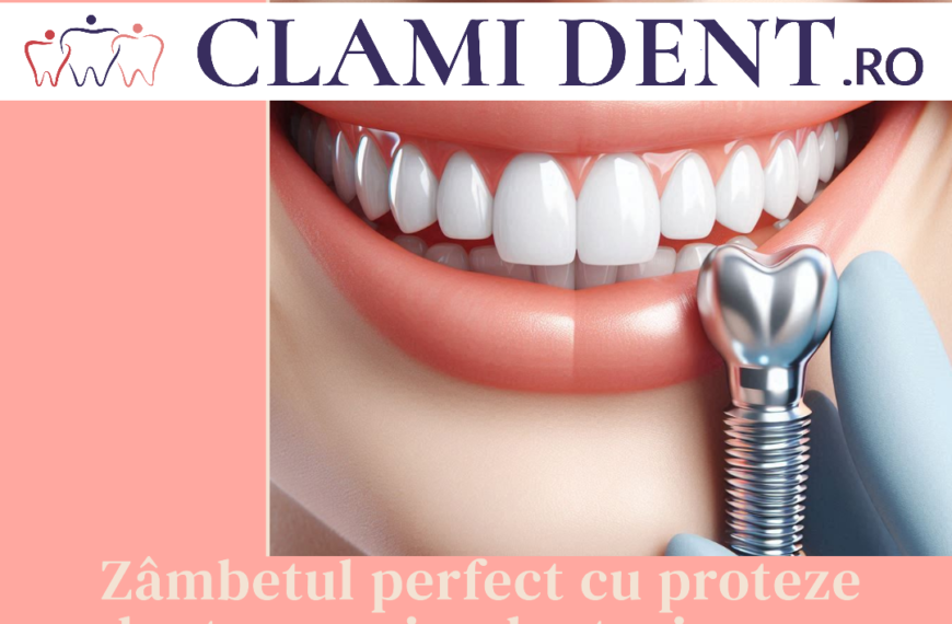 Cum se alege tipul potrivit de proteză dentară pe implanturi?