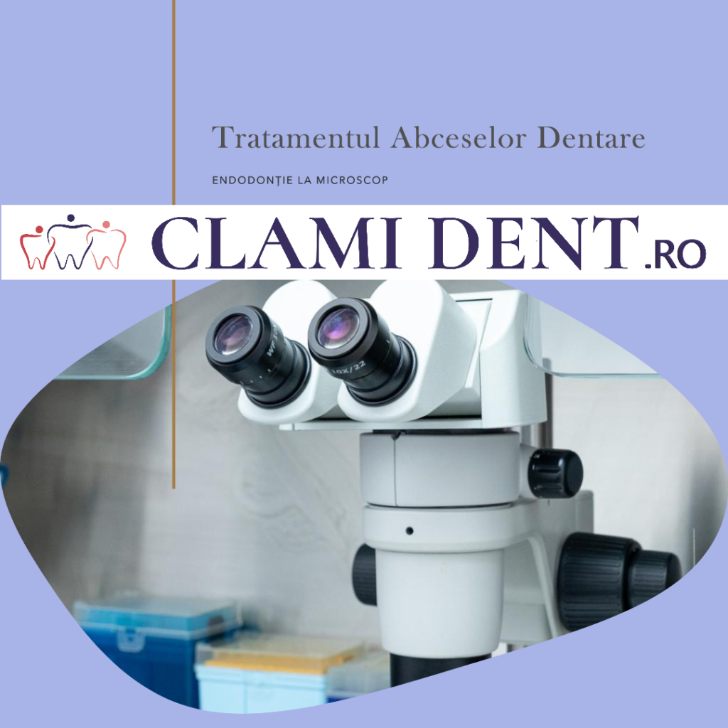 Endodonție la Microscop Cum Ajută la Tratamentul Abceselor Dentare