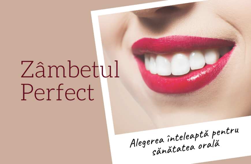Implant Dentar vs. Proteză Care Este Alegerea Corectă
