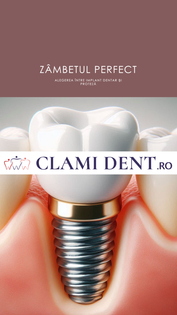 Implant Dentar vs. Proteză Care Este Alegerea Corectă