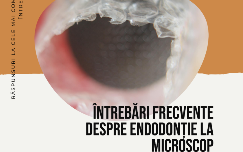 Întrebări Frecvente Despre Endodonție la Microscop Alba Iulia