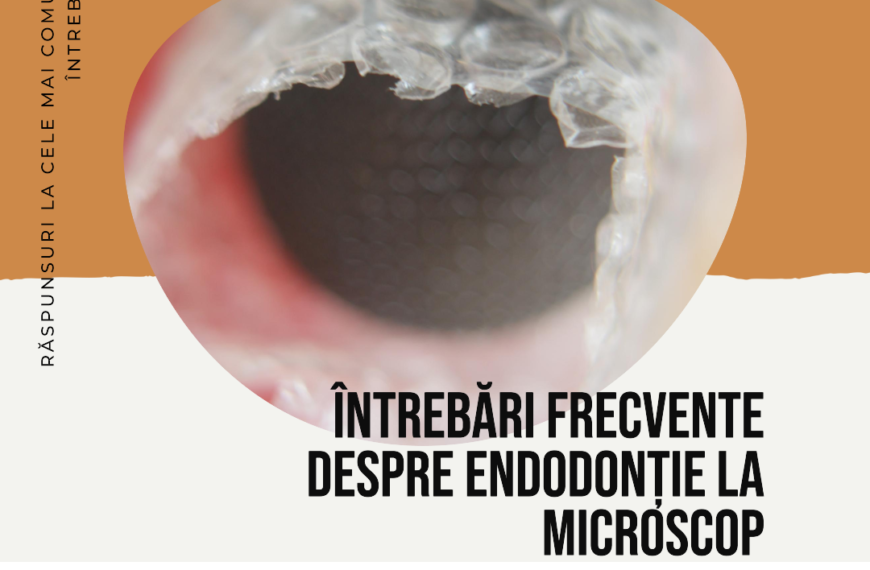 Întrebări Frecvente Despre Endodonție la Microscop Alba Iulia