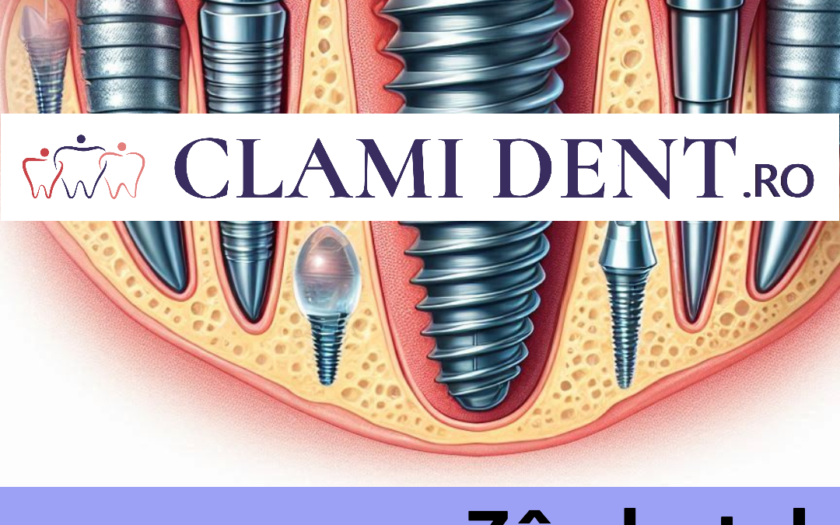 Procedura de Implant Dentar Explicată Pas cu Pas