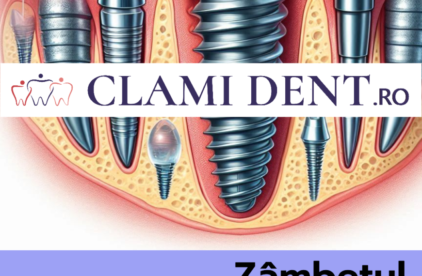 Procedura de Implant Dentar Explicată Pas cu Pas