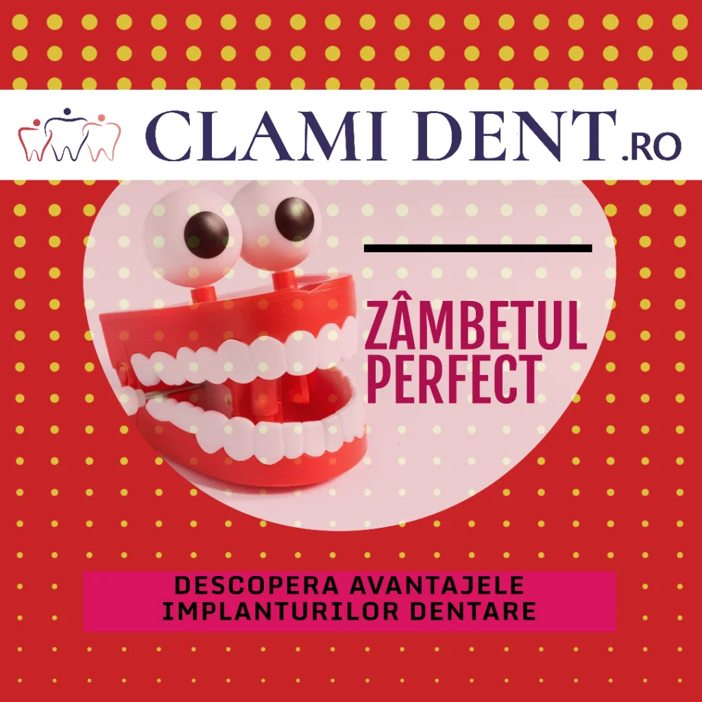 Avantajele Implanturilor Dentare față de Alte Soluții Dentare