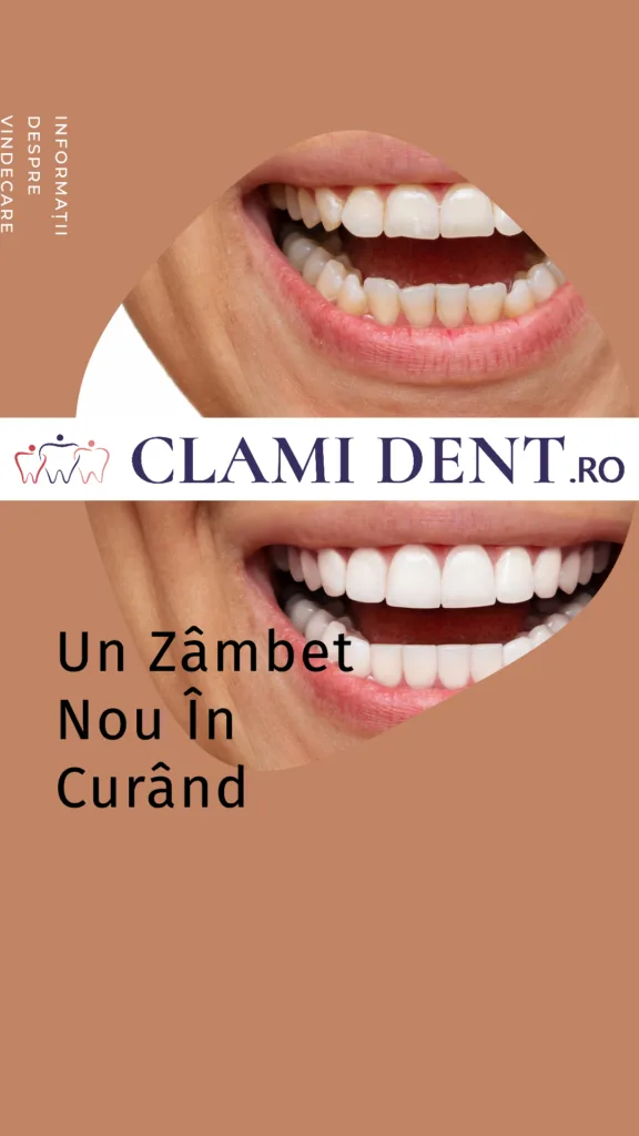 Cât Durează Vindecarea După Implantul Dentar?