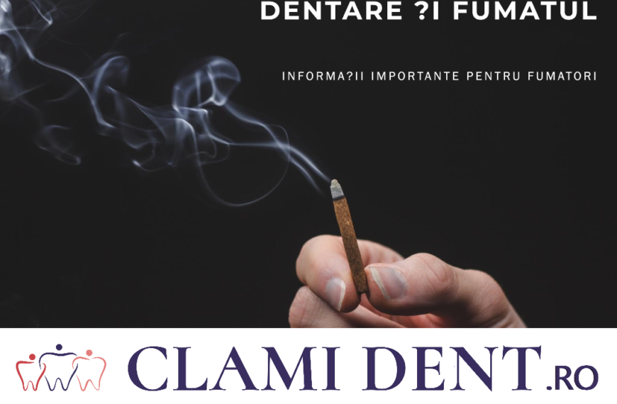 Este Implantul Dentar Sigur pentru Fumători?