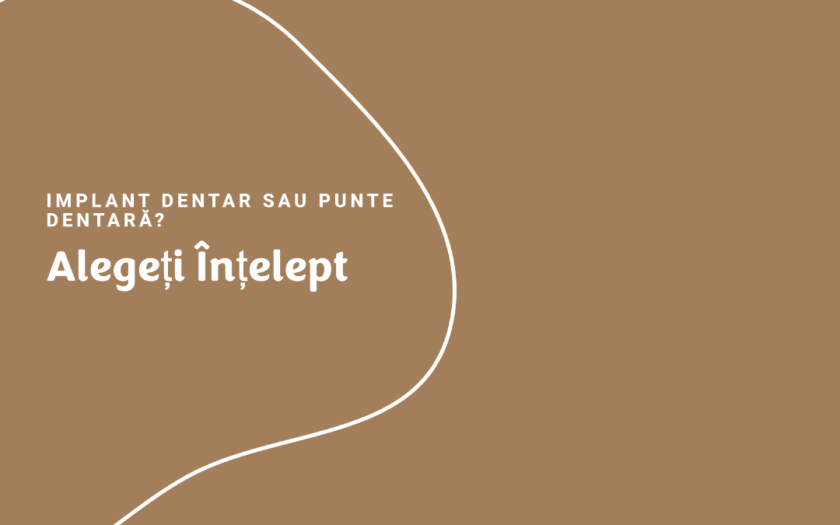 Implant Dentar sau Punte Dentară? Alege Înțelept