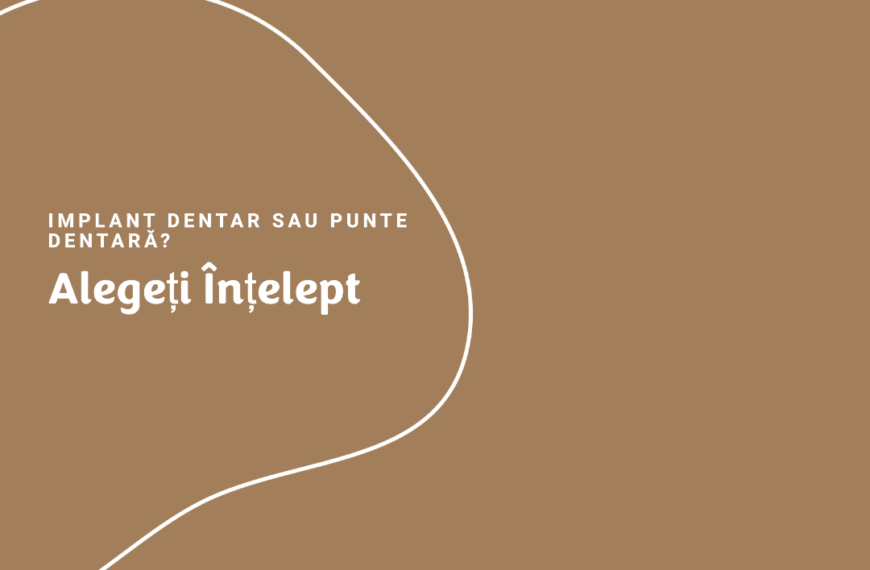 Implant Dentar sau Punte Dentară? Alege Înțelept