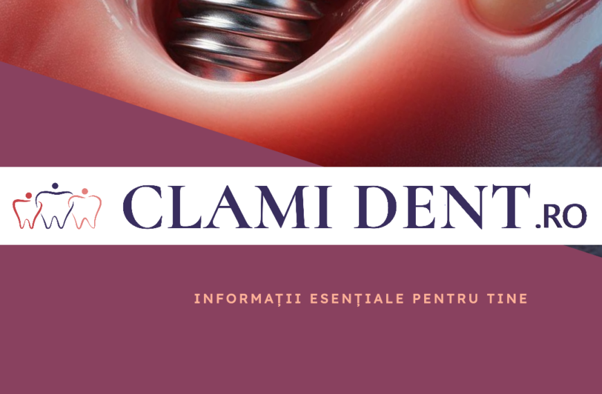 Implanturi Dentare De la A la Z, Tot ce Trebuie să Știi