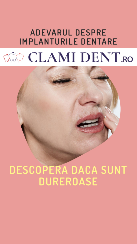 Sunt Implanturile Dentare Dureroase? Află Adevărul