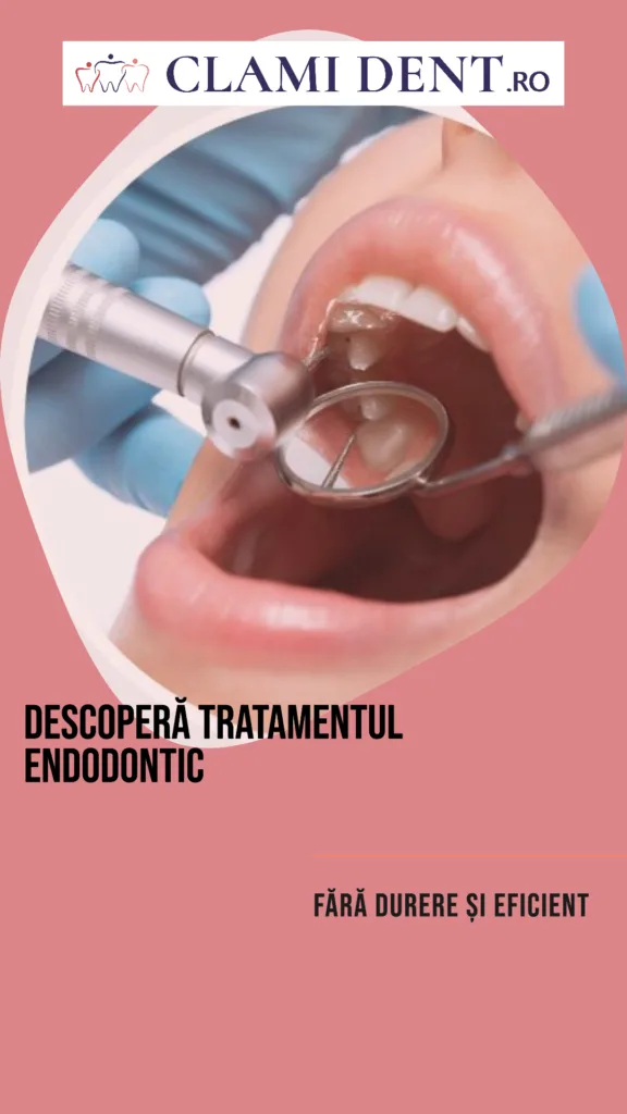 Tratament Endodontic Fără Durere cu Microscopul – Tot ce Trebuie să Știi Tratament Endodontic Fără Durere cu Microscopul – Tot ce Trebuie să Știi