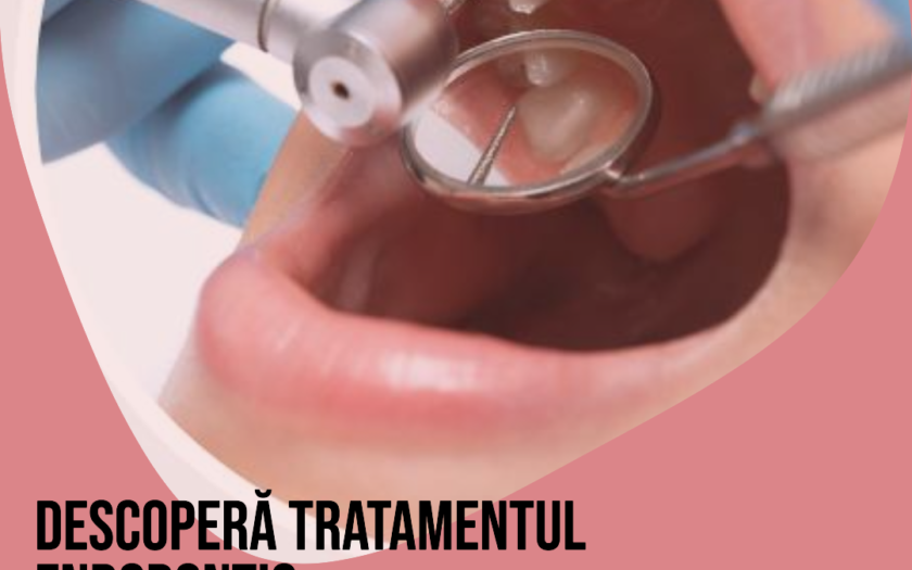 Tratament Endodontic Fără Durere cu Microscopul – Tot ce Trebuie să Știi Tratament Endodontic Fără Durere cu Microscopul – Tot ce Trebuie să Știi