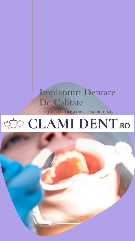 Implanturi Dentare din Titan Bio-Compatibil Soluția de Înaltă Calitate la ClamiDent Alba Iulia