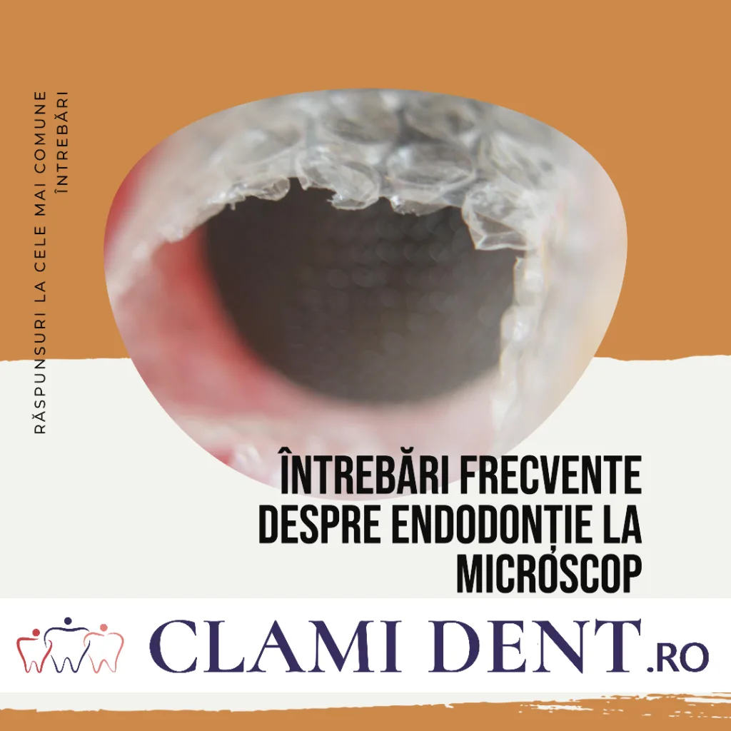 Întrebări Frecvente Despre Endodonție la Microscop