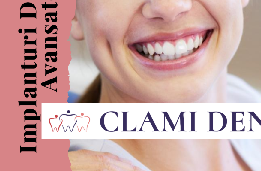 Implanturi Dentare cu Ancorare Multiplă Soluția Avansată la ClamiDent Alba Iulia
