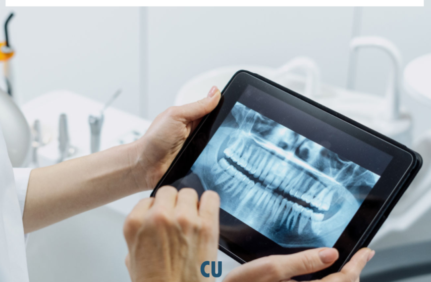 Implanturi Dentare cu Tehnologie Modernă Inovație și Precizie la ClamiDent Alba Iulia