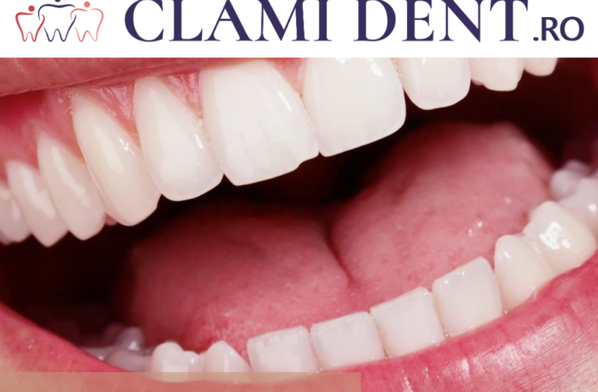 Implanturi Dentare de Înaltă Performanță Soluția Modernă la ClamiDent Alba Iulia
