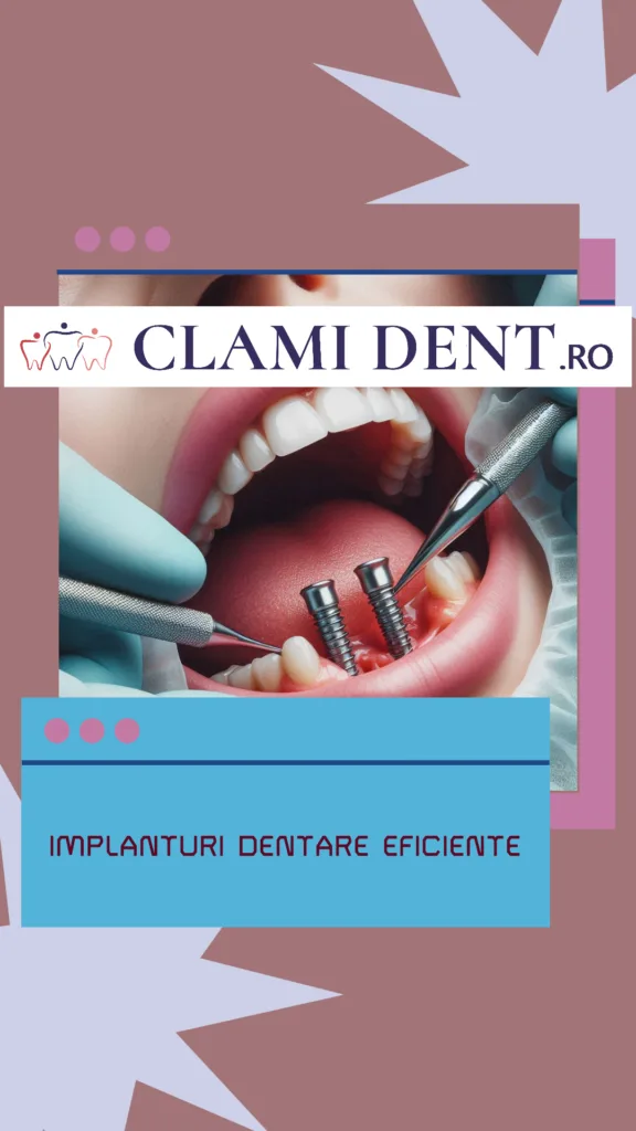 Implanturi Dentare pentru Restaurarea Funcției Redescoperă Puterea Masticatorie la ClamiDent Alba Iulia