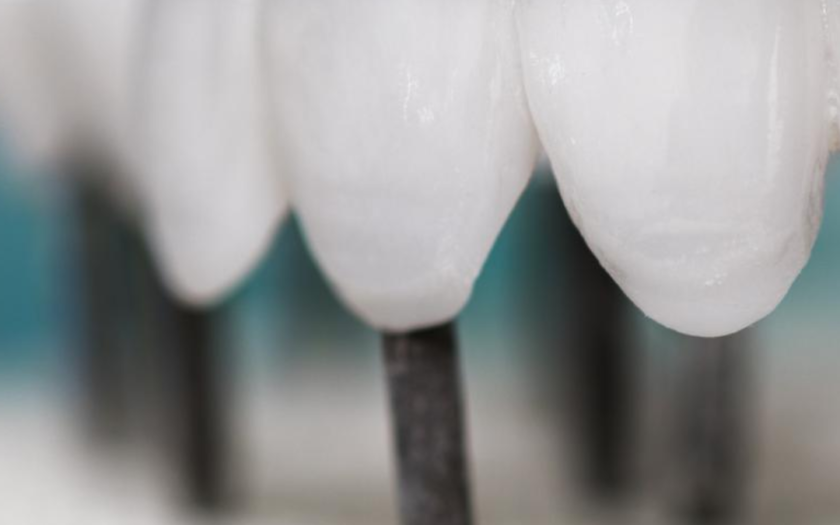 Clami Dent Alba Iulia – Expertiză în Implanturi Dentare