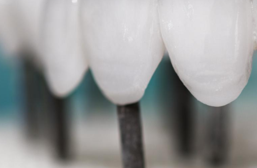 Clami Dent Alba Iulia – Expertiză în Implanturi Dentare