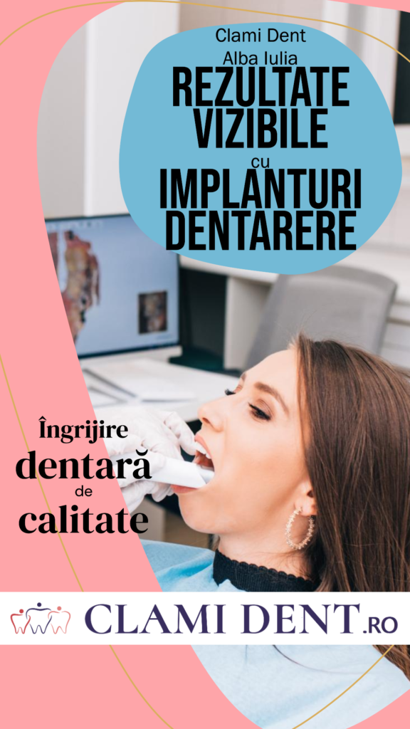 Clami Dent Alba Iulia – Rezultate Vizibile cu Implanturi Dentare