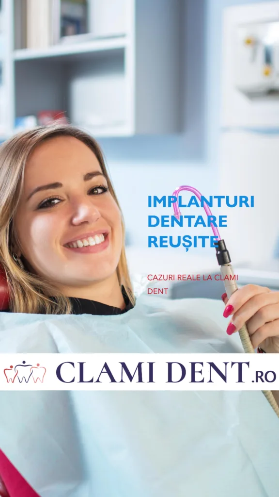 Implanturi Dentare Reușite la Clami Dent Alba Iulia – Cazuri Reale