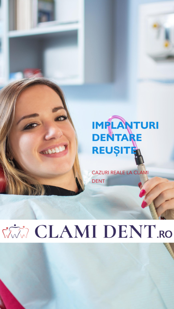 Implanturi Dentare Reușite la Clami Dent Alba Iulia – Cazuri Reale