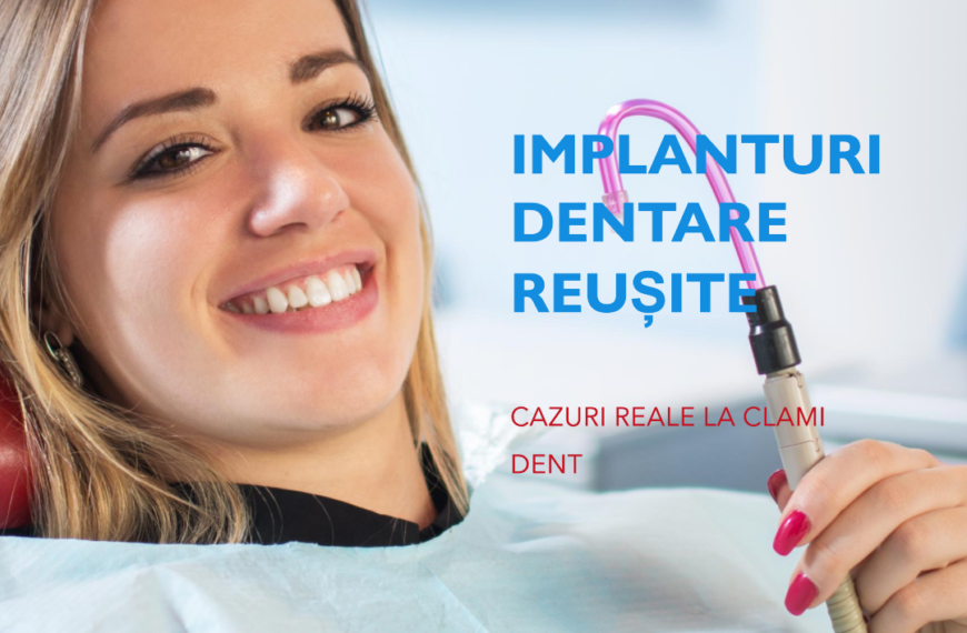 Implanturi Dentare Reușite la Clami Dent Alba Iulia – Cazuri Reale