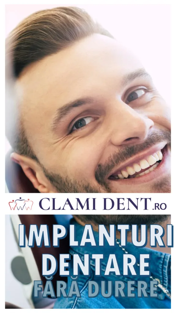 Implanturi Dentare fără Durere la Clami Dent Alba Iulia – Realitate Modernă