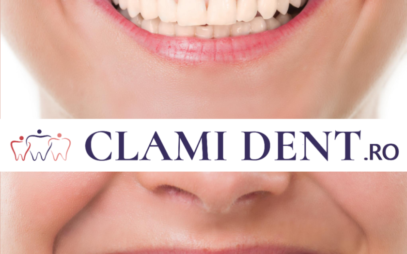 Albire Dentară Profesională la Clami Dent Alba Iulia