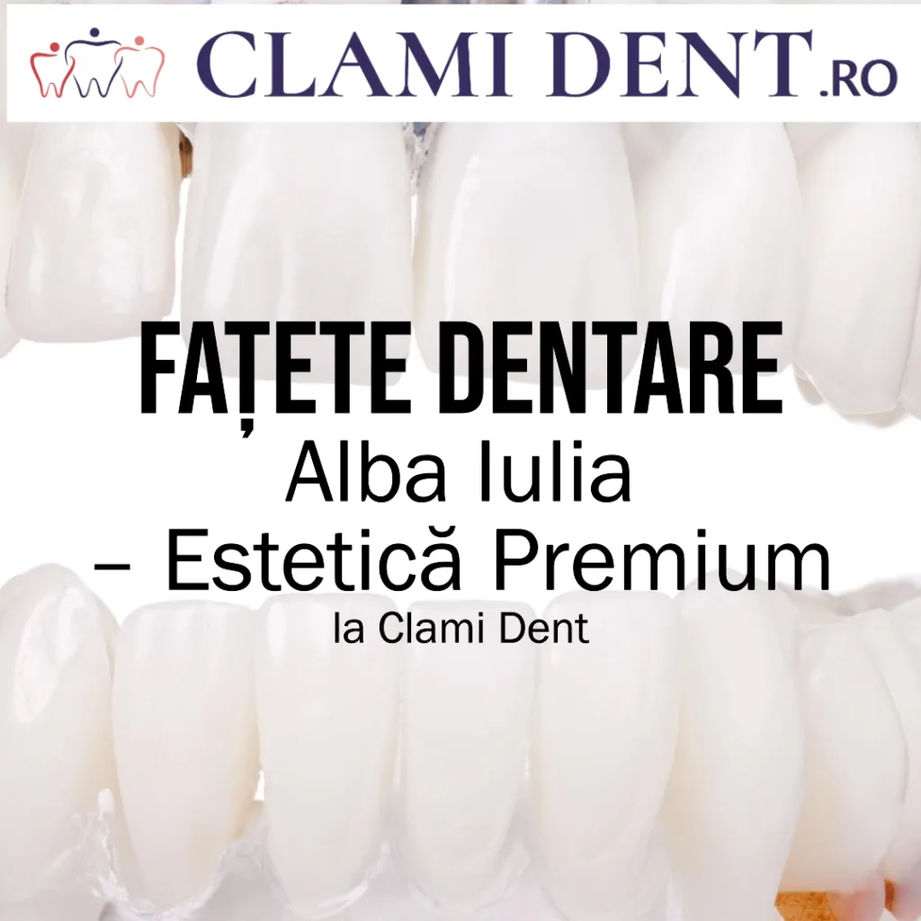 Fațete Dentare Alba Iulia – Estetică Premium la Clami Dent