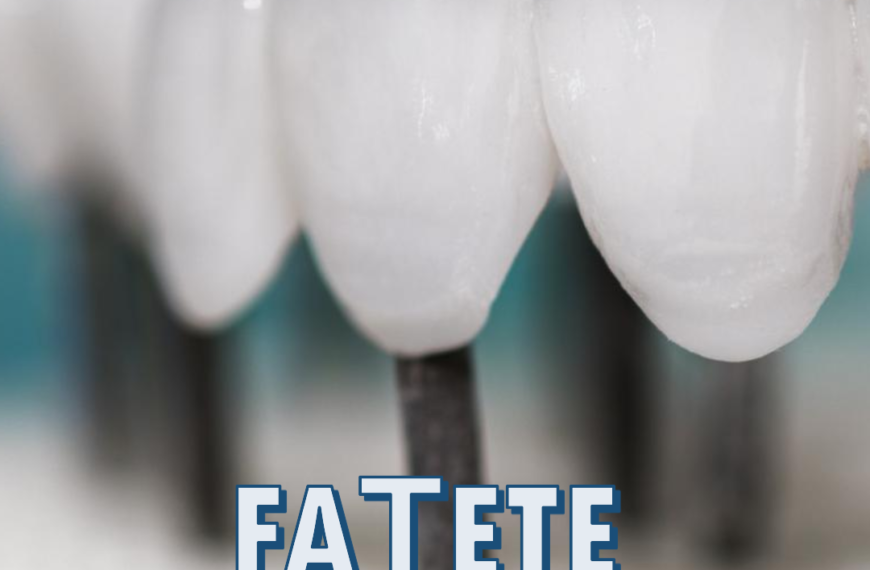 Fațete Dentare de Porțelan la Clinica Clami Dent