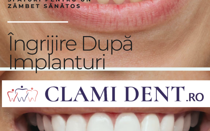 Implanturi Dentare Sfaturi pentru Menținerea Zâmbetului După Tratament