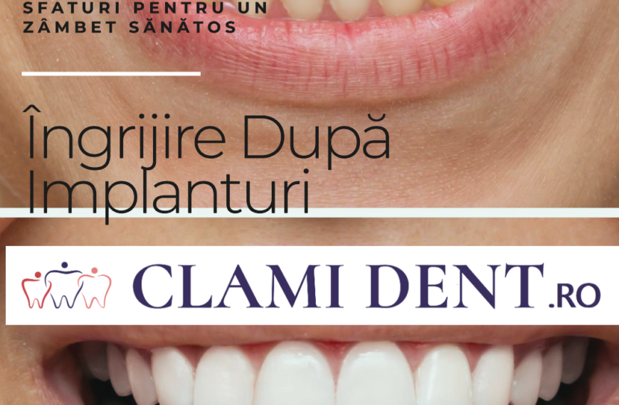 Implanturi Dentare Sfaturi pentru Menținerea Zâmbetului După Tratament
