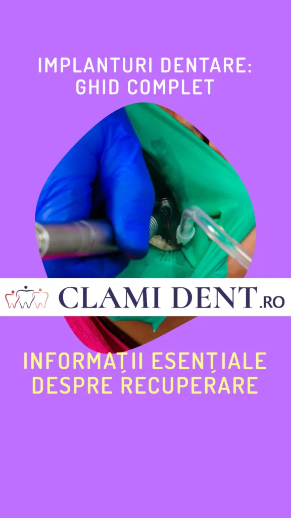 Implanturi Dentare Tot Ce Trebuie Să Știi Despre Recuperare