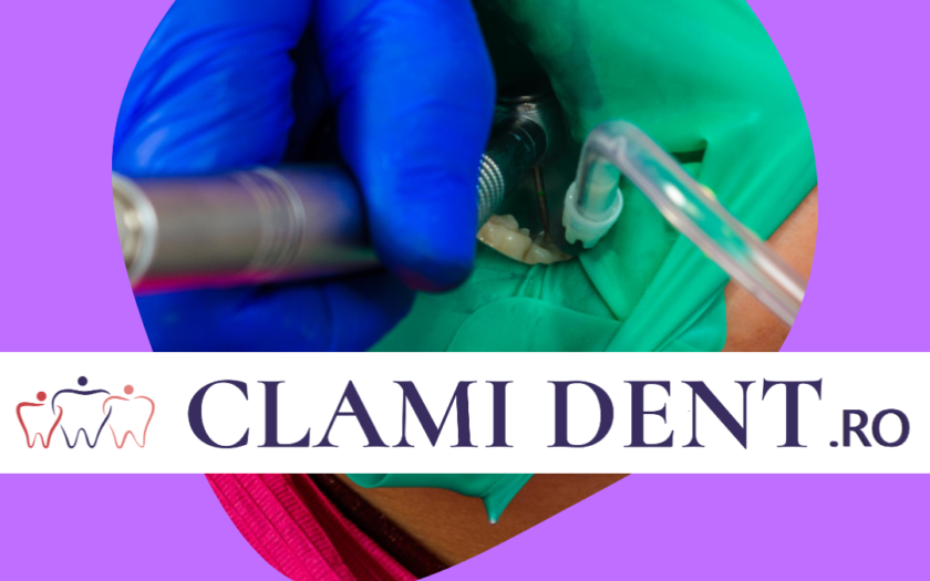Implanturi Dentare Tot Ce Trebuie Să Știi Despre Recuperare