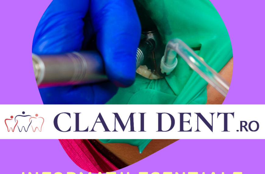 Implanturi Dentare Tot Ce Trebuie Să Știi Despre Recuperare