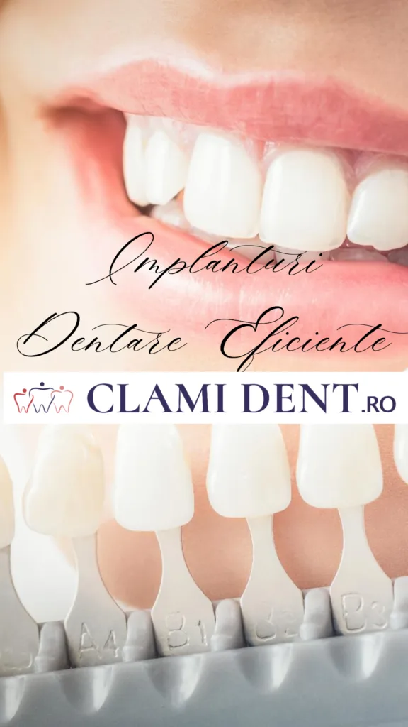 Implanturi Dentare Tot ce Trebuie să Știi