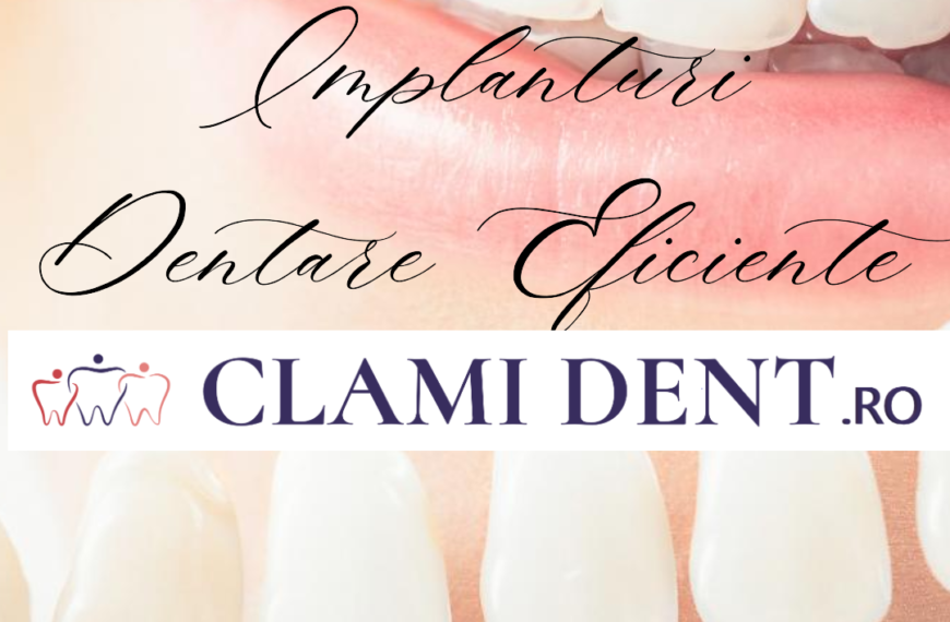 Implanturi Dentare Tot ce Trebuie să Știi