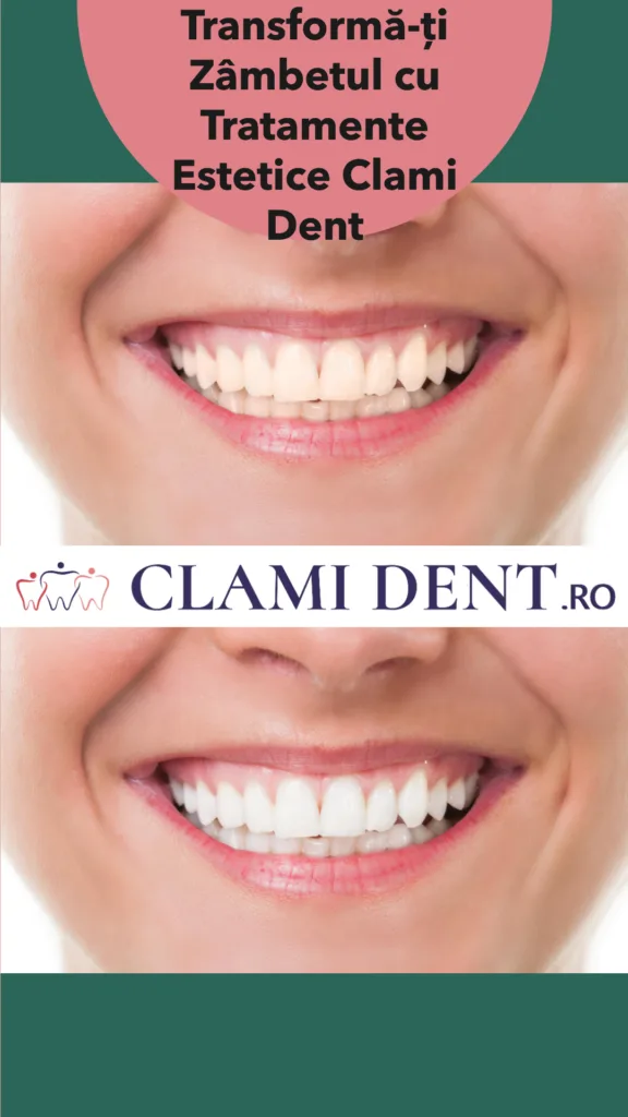 Transformă-ți Zâmbetul cu Tratamente Estetice Clami Dent