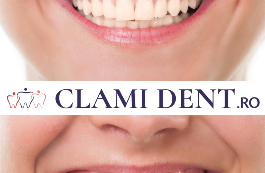 Transformă-ți Zâmbetul cu Tratamente Estetice Clami Dent