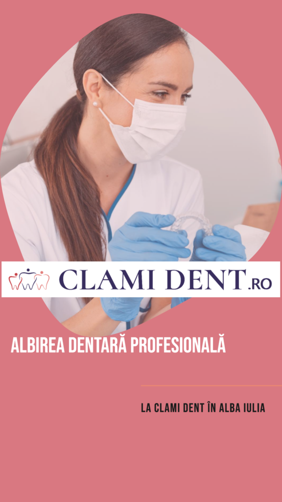 Albirea dentară profesională la Clami Dent în Alba Iulia