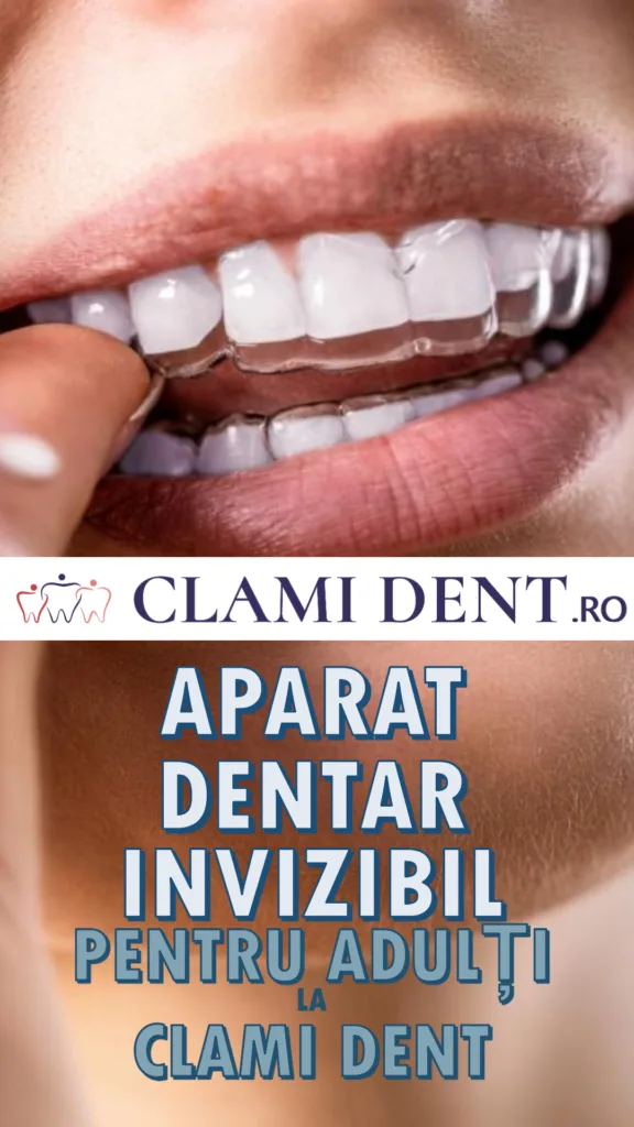 Aparat dentar invizibil pentru adulți la Clami Dent