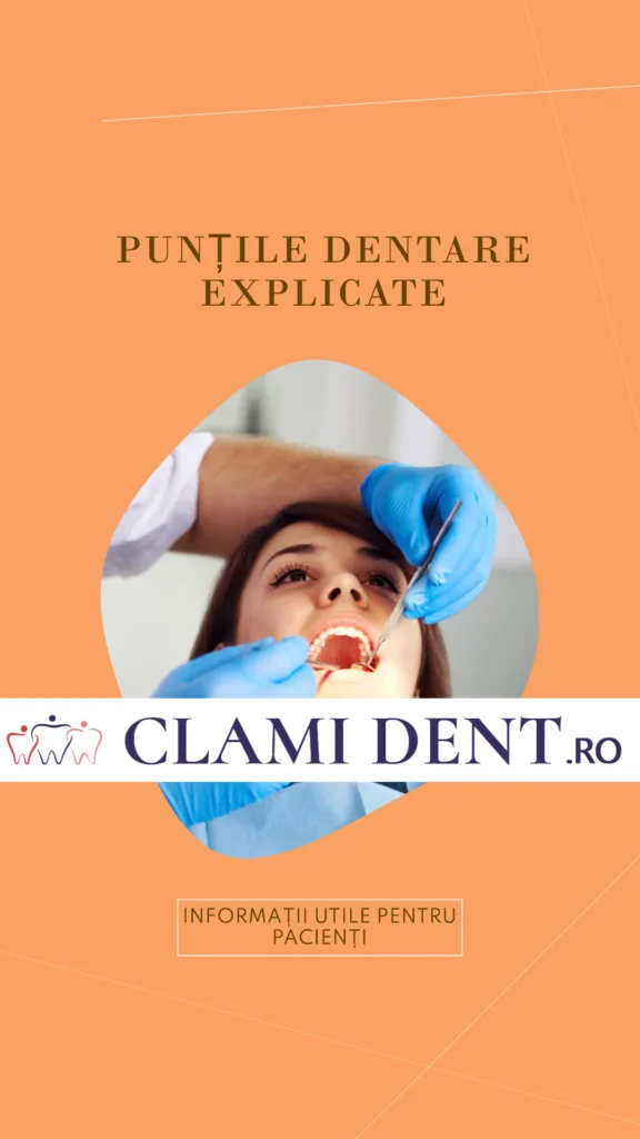 Ce sunt punțile dentare și cui se recomandă