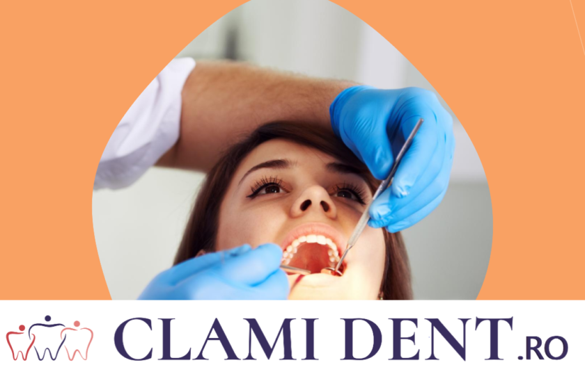 Ce sunt punțile dentare și cui se recomandă