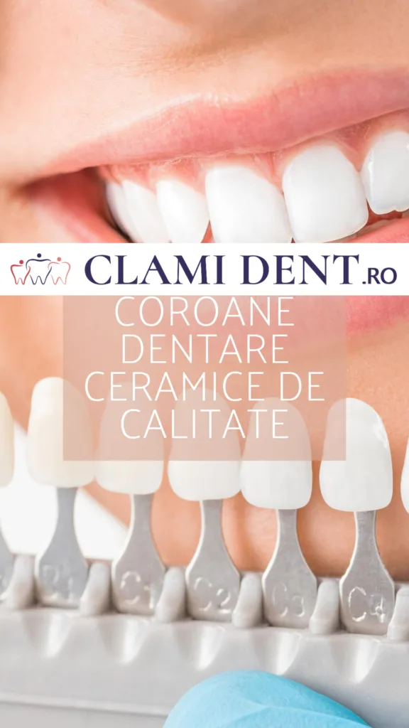 Coroane dentare ceramice la Clami Dent Alba Iulia