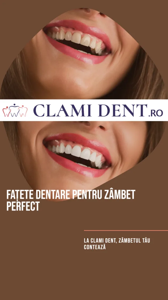 Fațete dentare la Clami Dent pentru un zâmbet perfect