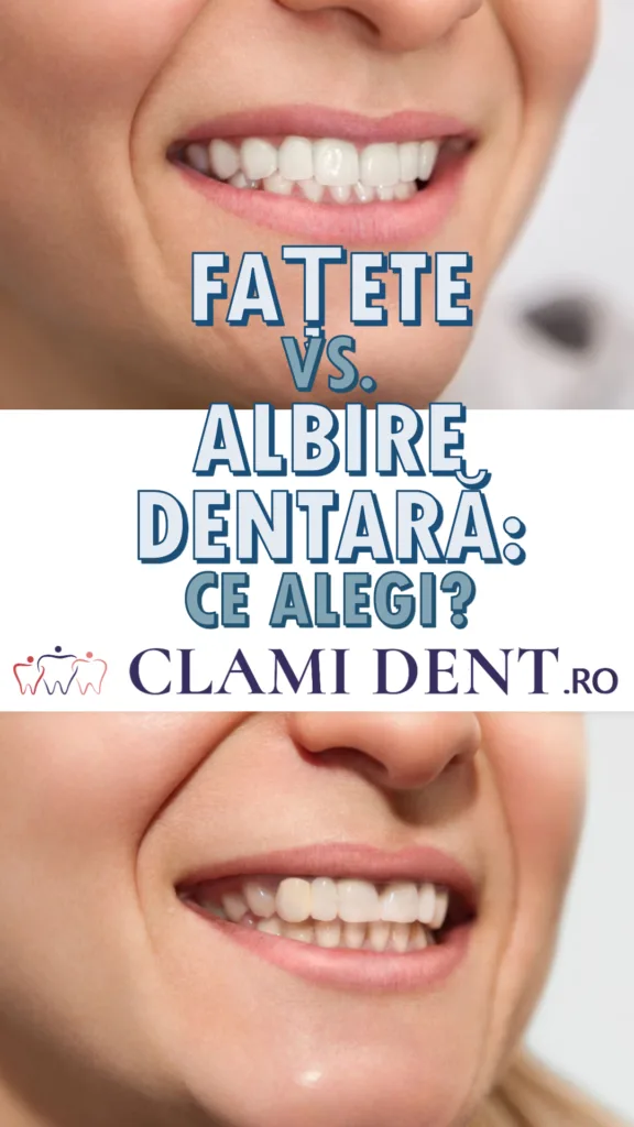 Fațete vs. albire dentară ce alegi