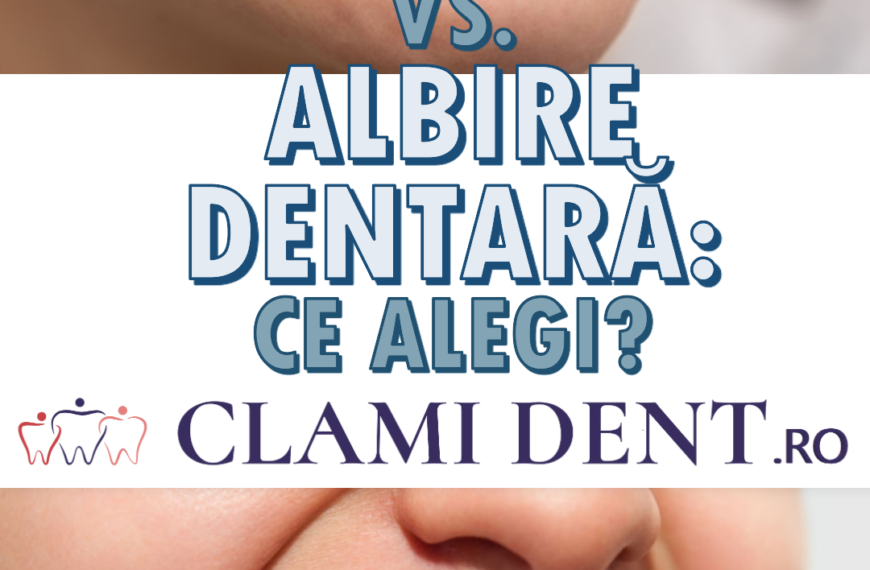 Fațete vs. albire dentară ce alegi